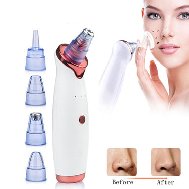 Electric Vacuum Pore Cleanser
